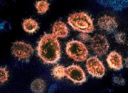 Covid-19: Cientistas descobrem método inédito que impede que o vírus infecte as células
